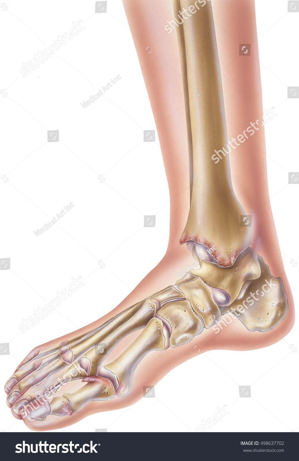 Rhfoot Images, Stock Photos & Vectors | Shutterstock