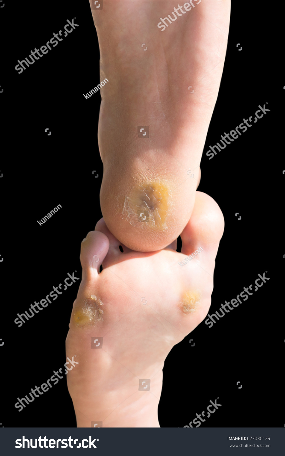 black foot corn
