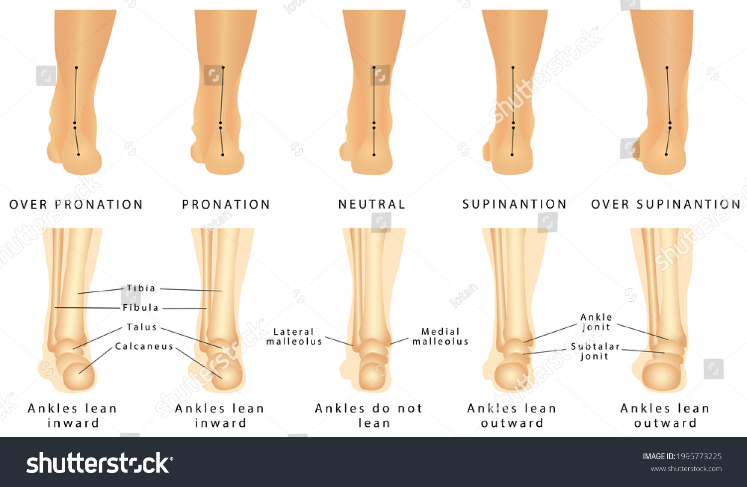 Hindfoot Images, Stock Photos & Vectors | Shutterstock