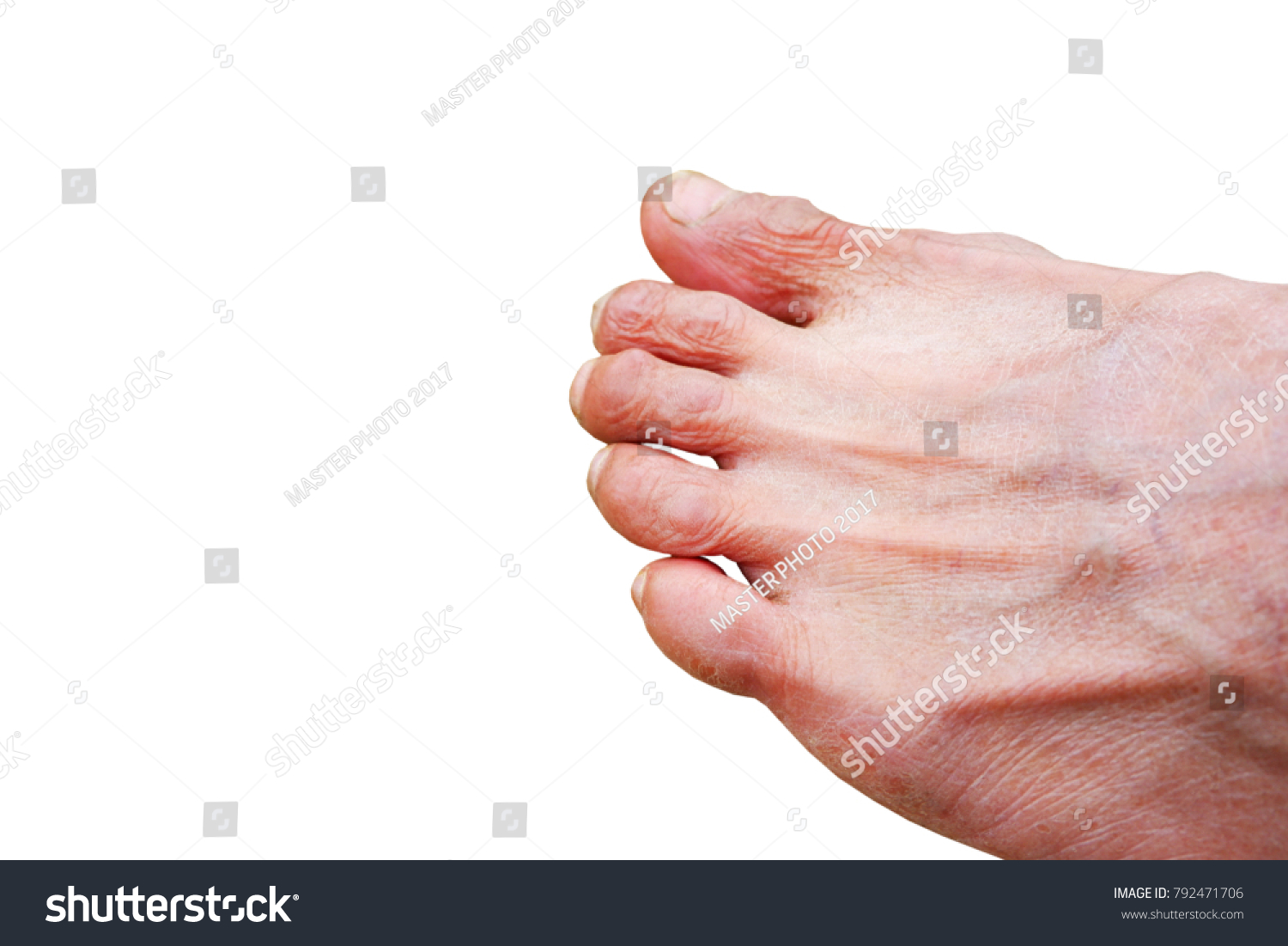 Foot Asian Man Withered Skin Toe Stock Photo 792471706 | Shutterstock