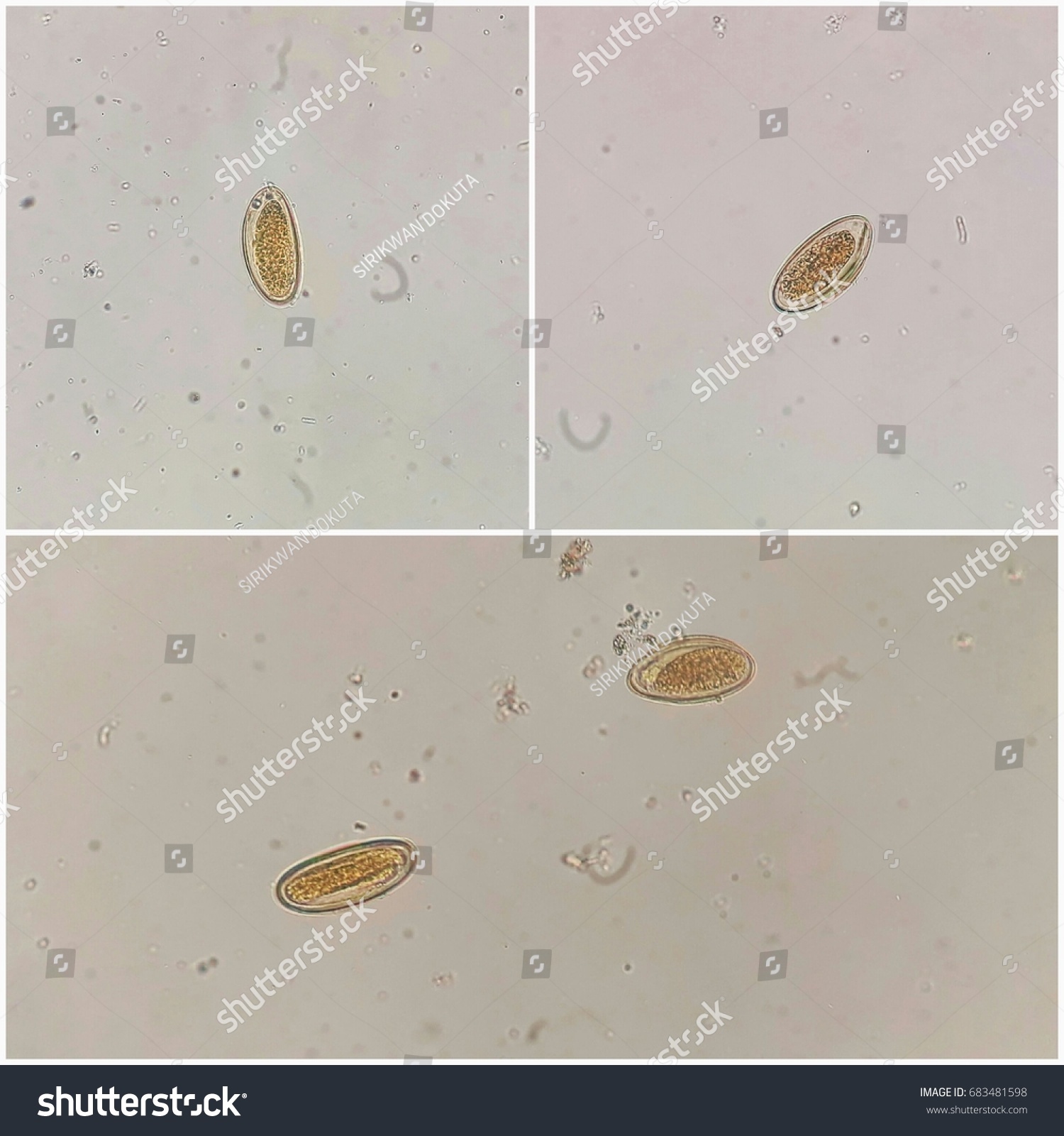 enterobius vermicularis in stool bacterii multirezistente