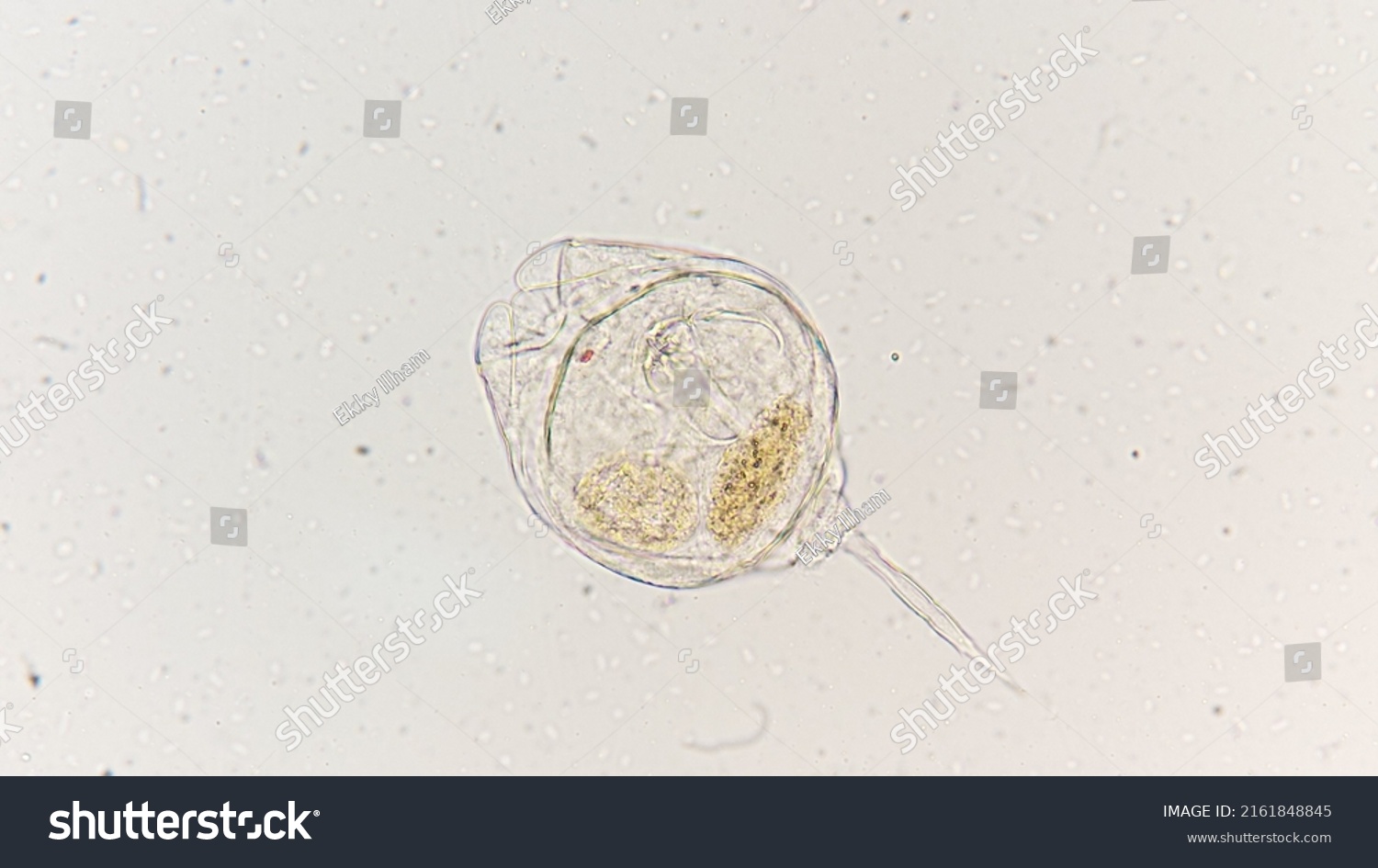 Freshwater Rotifer 400x Microscope Magnification Stock Photo 2161848845 ...