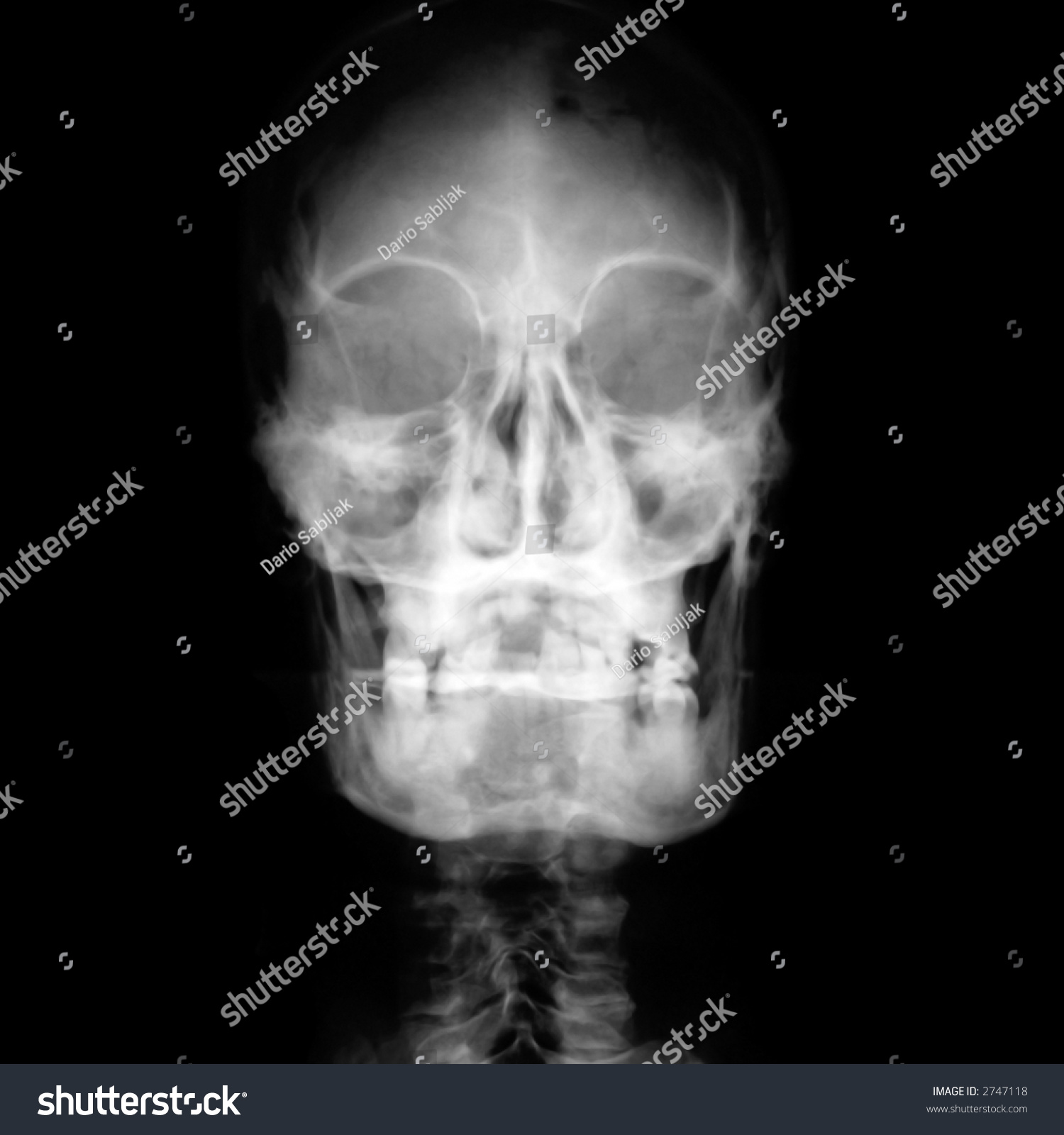 Front Face On X-Ray Film Stock Photo 2747118 : Shutterstock