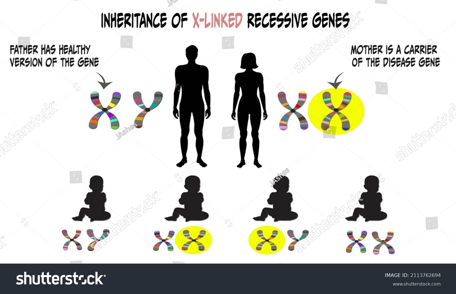 Genetic Inheritance X Chromosome Linked Recessive Stock Illustration ...