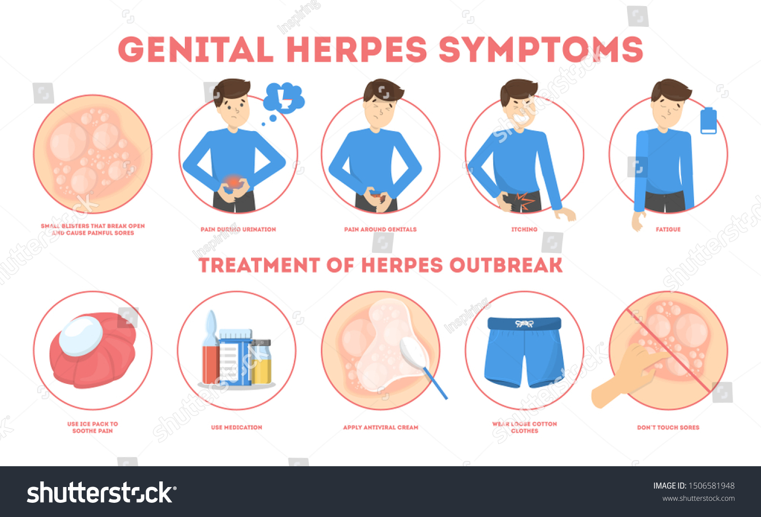 Genital Herpes Symptoms Infectious Dermatology Disease Stock ...