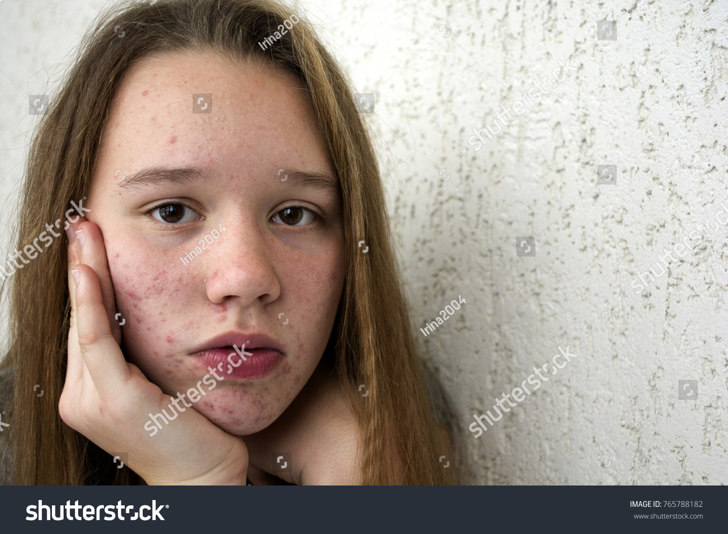 ugly-girl-images-stock-photos-vectors-shutterstock