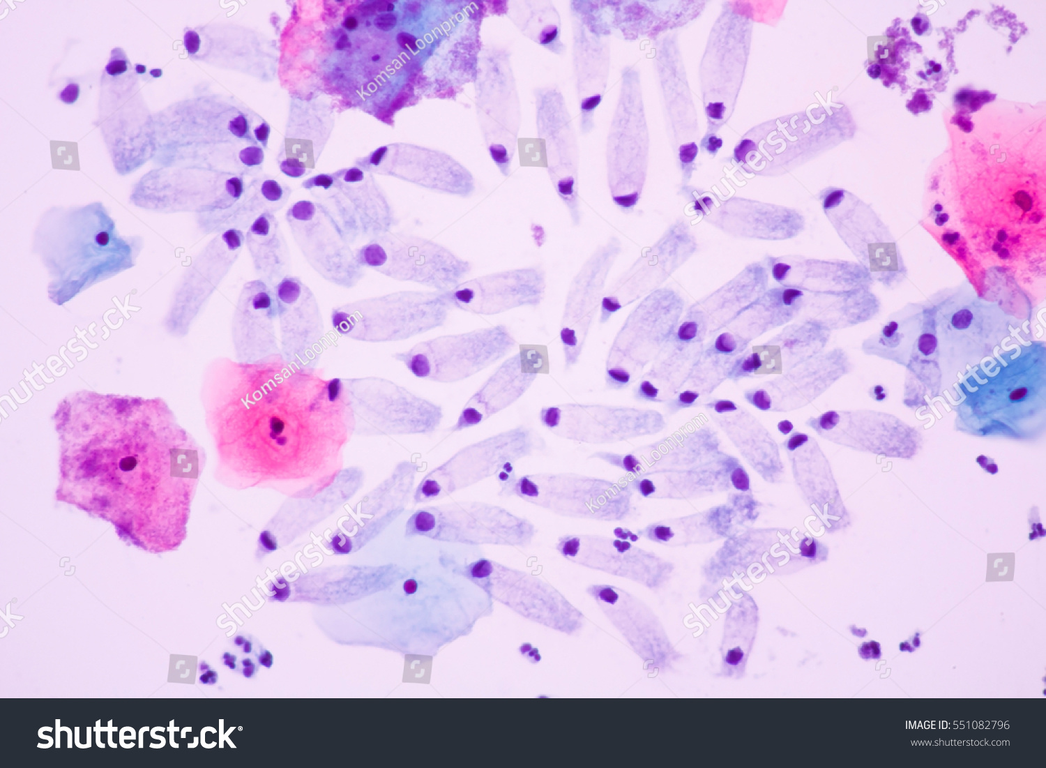 Epithelial Cells Microscope 5896