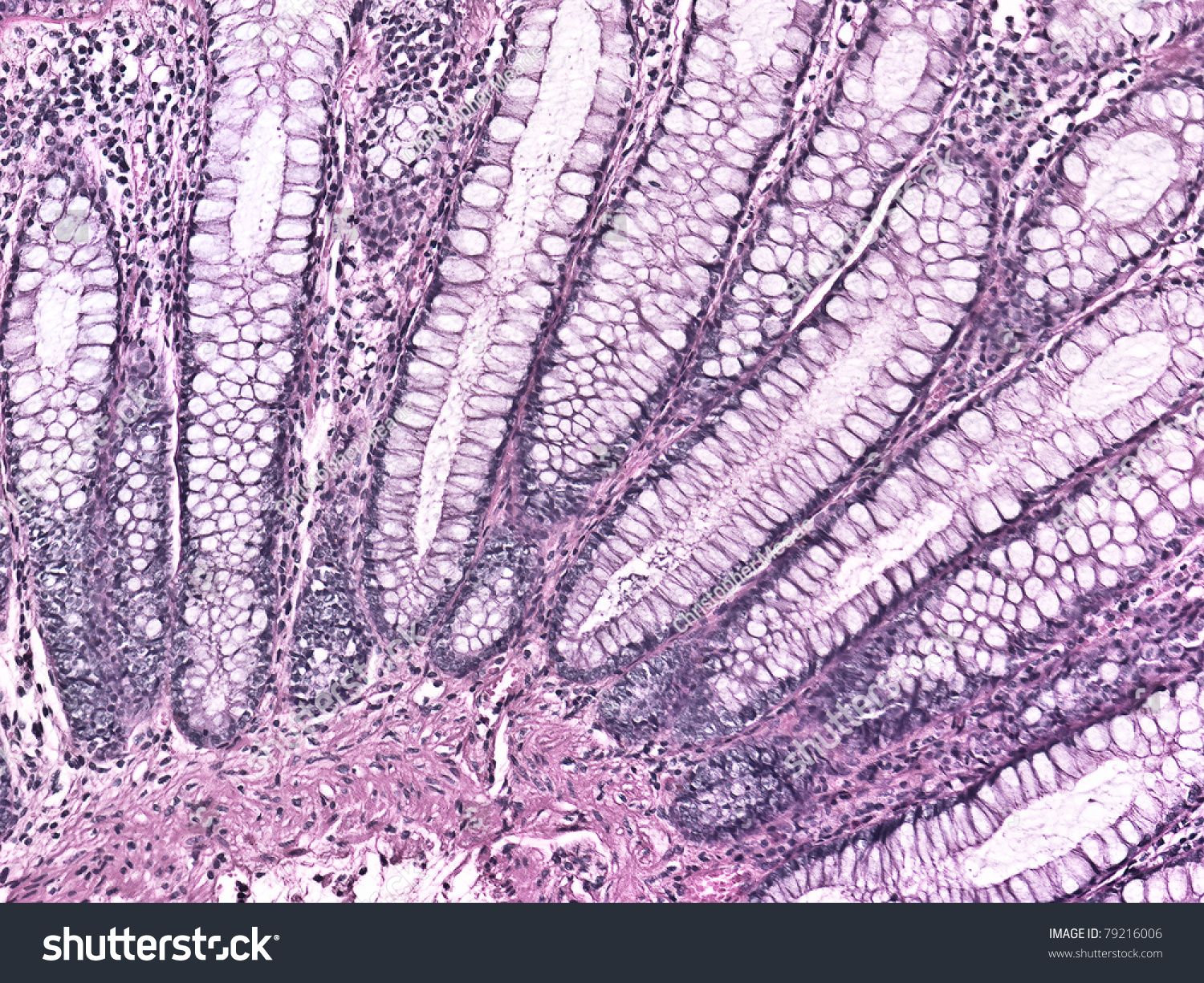 Glandular Tissue 20x Magnification Stock Photo 79216006 - Shutterstock