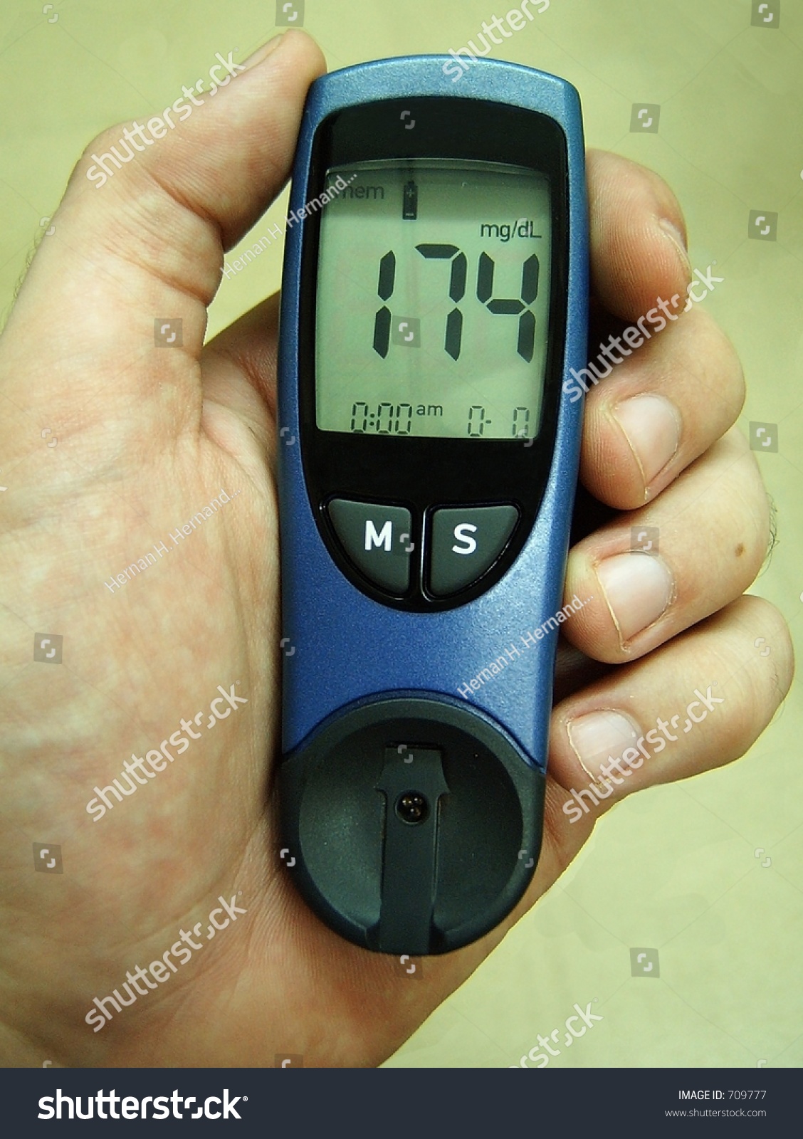 Glucometer Stock Photo 709777 : Shutterstock