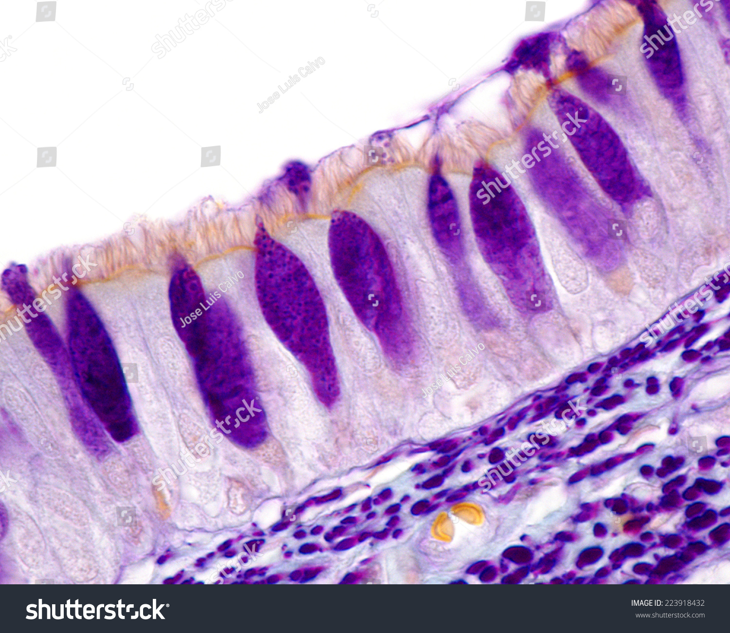 Goblet Cells Trachea Histology