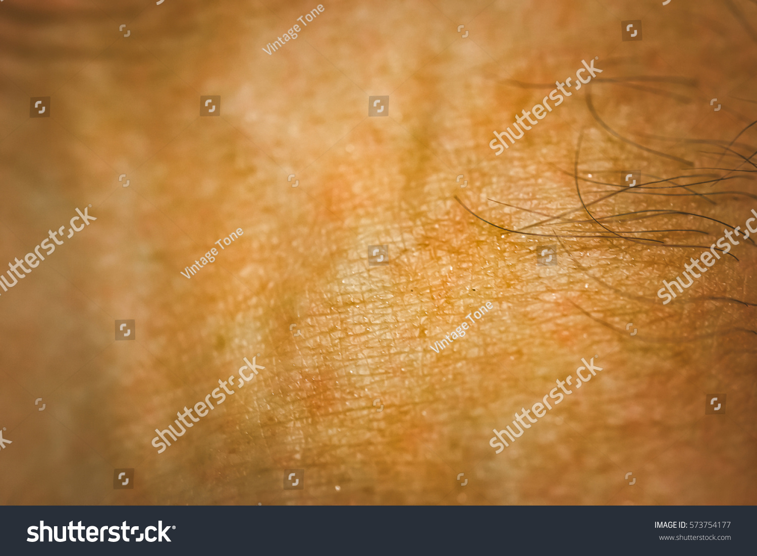 goose bumps on human skin closeup stock photo 556019386 goose bumps on human skin closeup stock photo 573754177 goose bumps on human skin closeup stock photo 556019386 goose bumps on human skin closeup stock photo 573754177