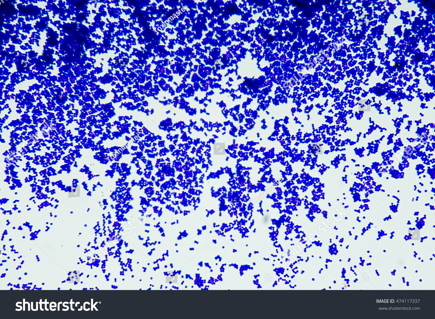 Gram Positive Bacilli Bacteria Microbiology Stock Photo 474117337 ...