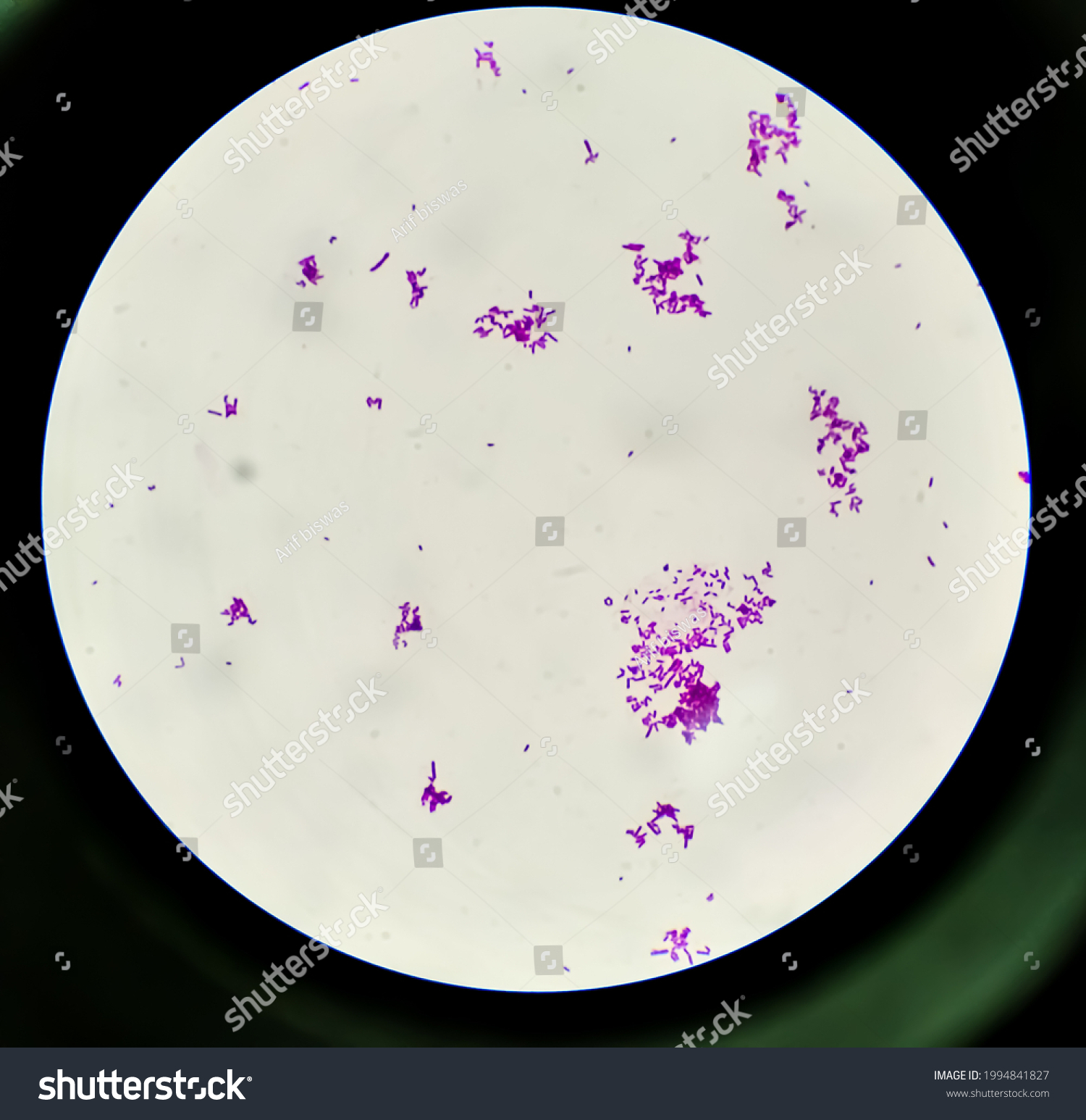 Grampositive Bacteria Streptococcus Pyogenes Which Cause Stock Photo ...