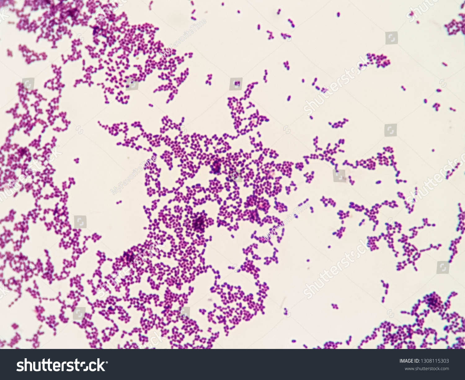 Gram Positive Cocci Cluster Stapylococcus Spp Stock Photo 1308115303 ...