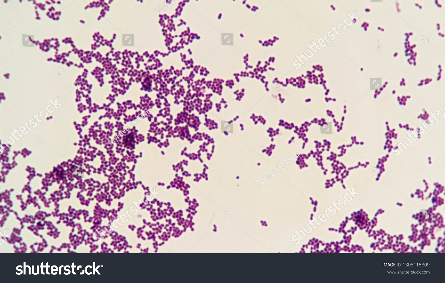 Gram Positive Cocci Cluster Stapylococcus Spp Stock Photo (Edit Now ...