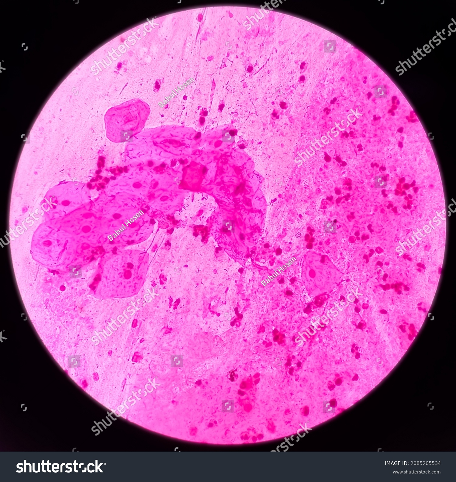 Gram Stain Microscopic Slide Plenty Epithelial Stock Photo (Edit Now ...