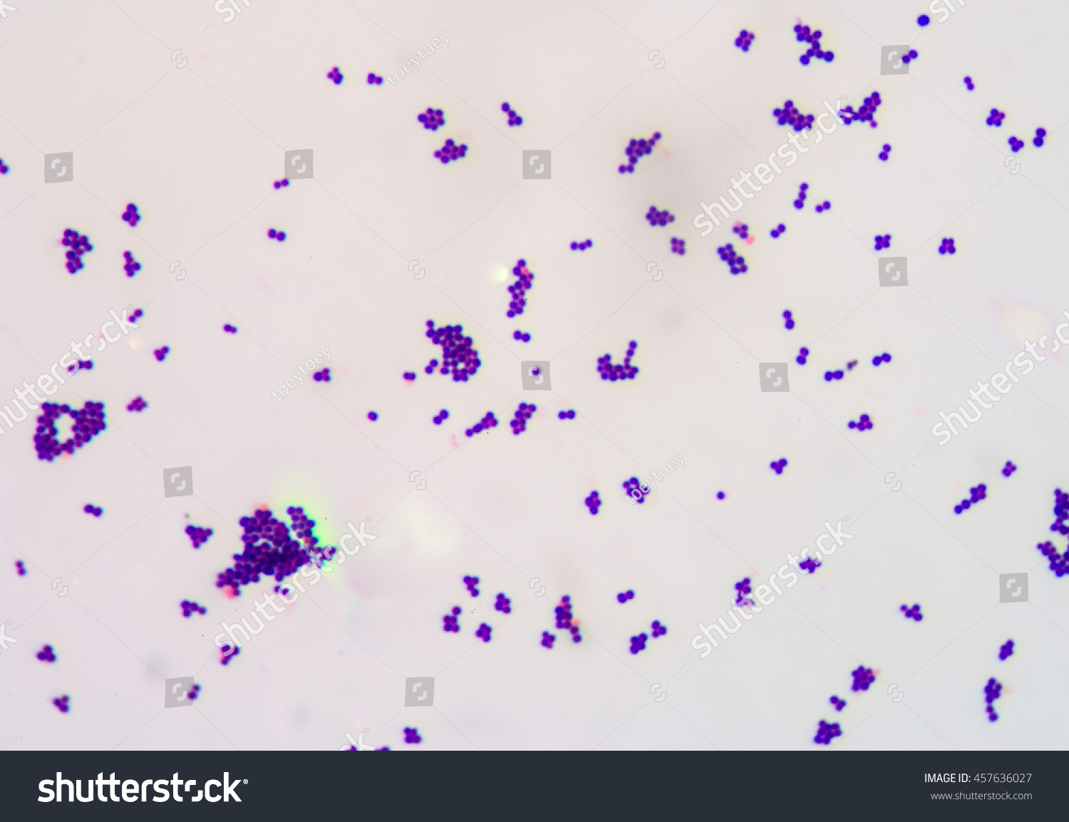 Gram Staining Called Grams Method Method Stock Photo 457636027 ...