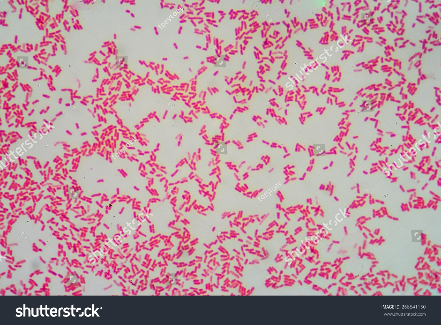 Gram Staining,Negative Bacilli. Stock Photo 268541150 : Shutterstock