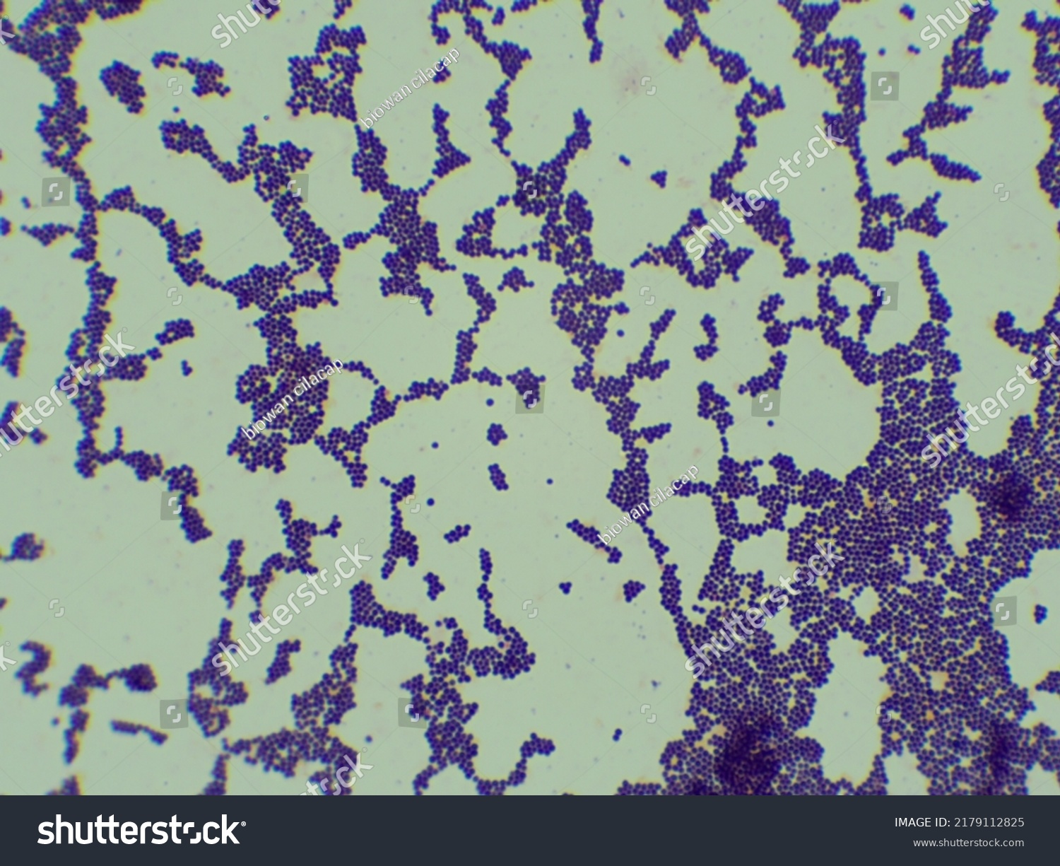 Gram Staining Staphylococcus Aureus Under Microscopes库存照片2179112825 ...