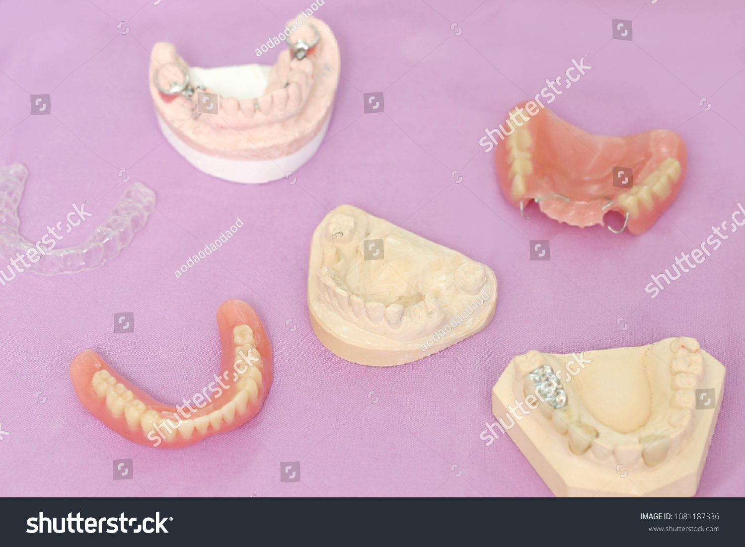 Group Partial Metal Denture Removable Prosthesis Stock Photo (Edit Now ...