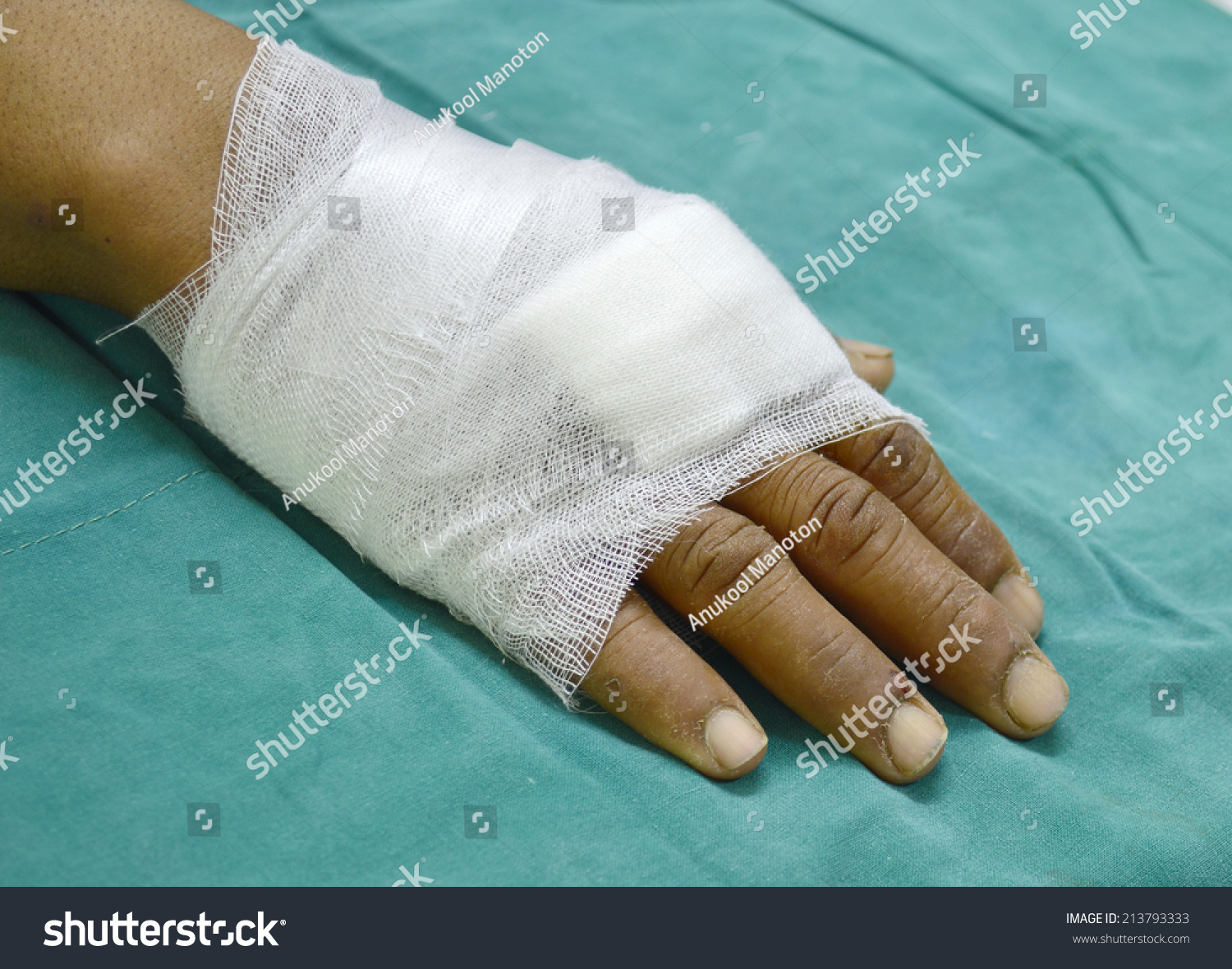 dressing hand pic