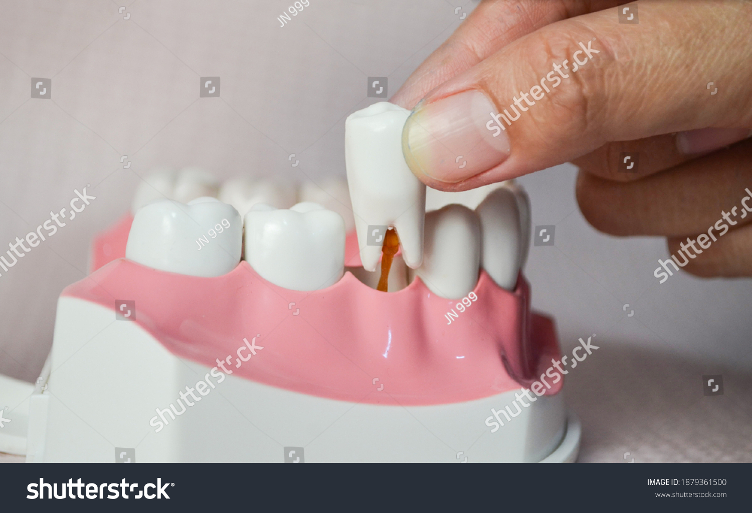 Hand Extracting Molar Tooth Hand Pulling Stock Photo 1879361500 Hand Extracting Molar Tooth Hand Pulling Stock Photo 1879361500