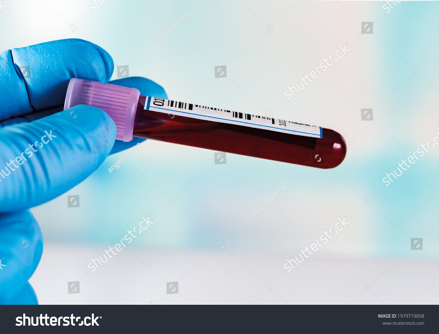 1,881 Clotted blood tube Images, Stock Photos & Vectors | Shutterstock