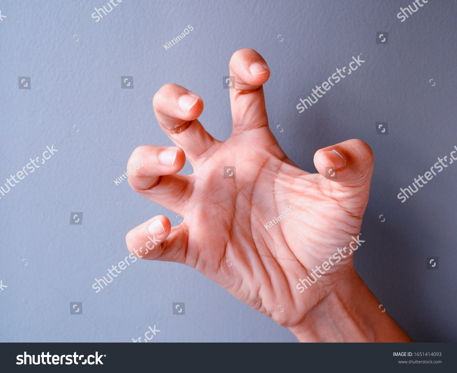 Hand Asian Woman Spasms Hand Twitches Stock Photo (Edit Now) 1651414093