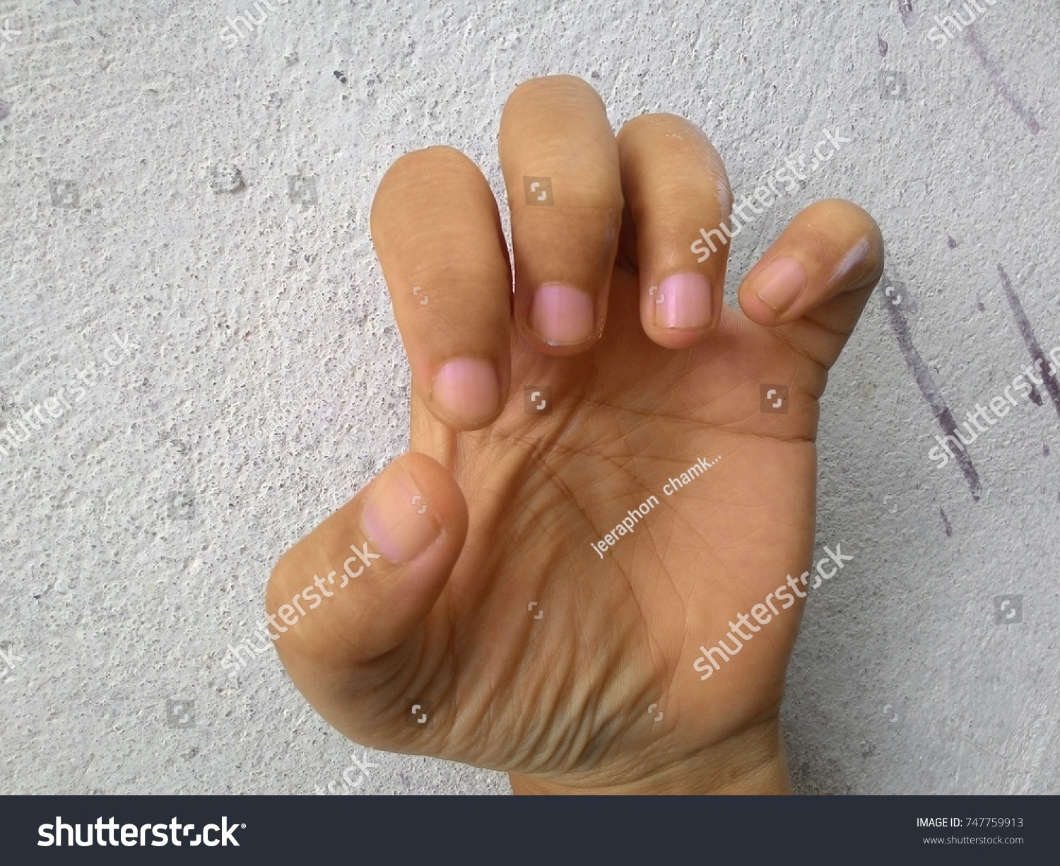 Why the fingers are bent nails and what should be done to fix it Why the fingers are bent nails and what should be done to fix it