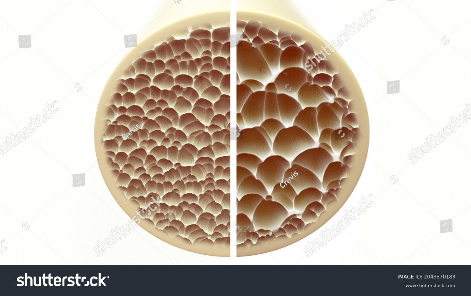 1,964 Bone density Images, Stock Photos & Vectors Biology Diagrams