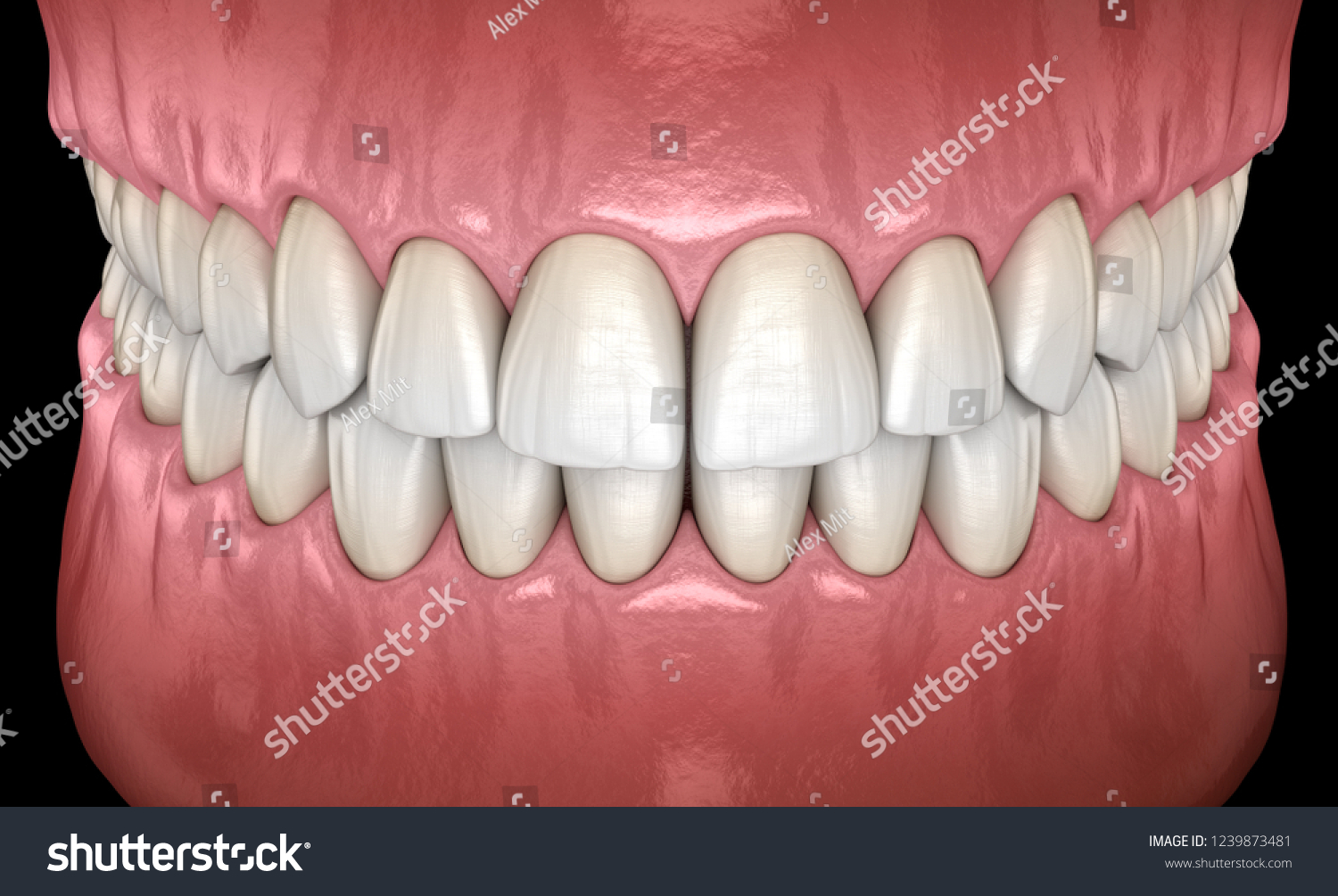 正常な咬合正面視を持つ健康な人間の歯 医学的に正確な歯の3dイラスト のイラスト素材
