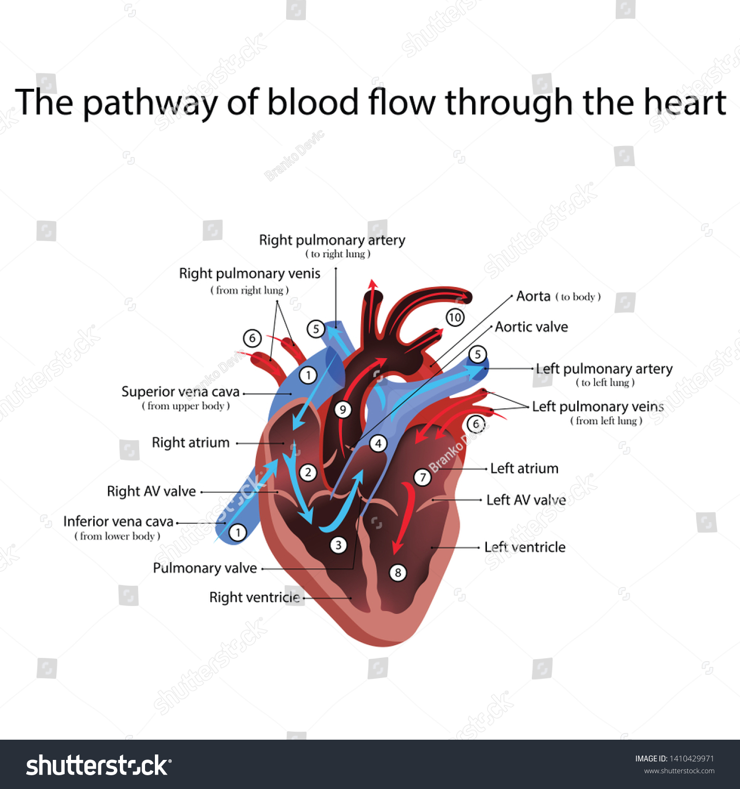 心臓解剖学と心臓疾患の種類のイラスト のイラスト素材