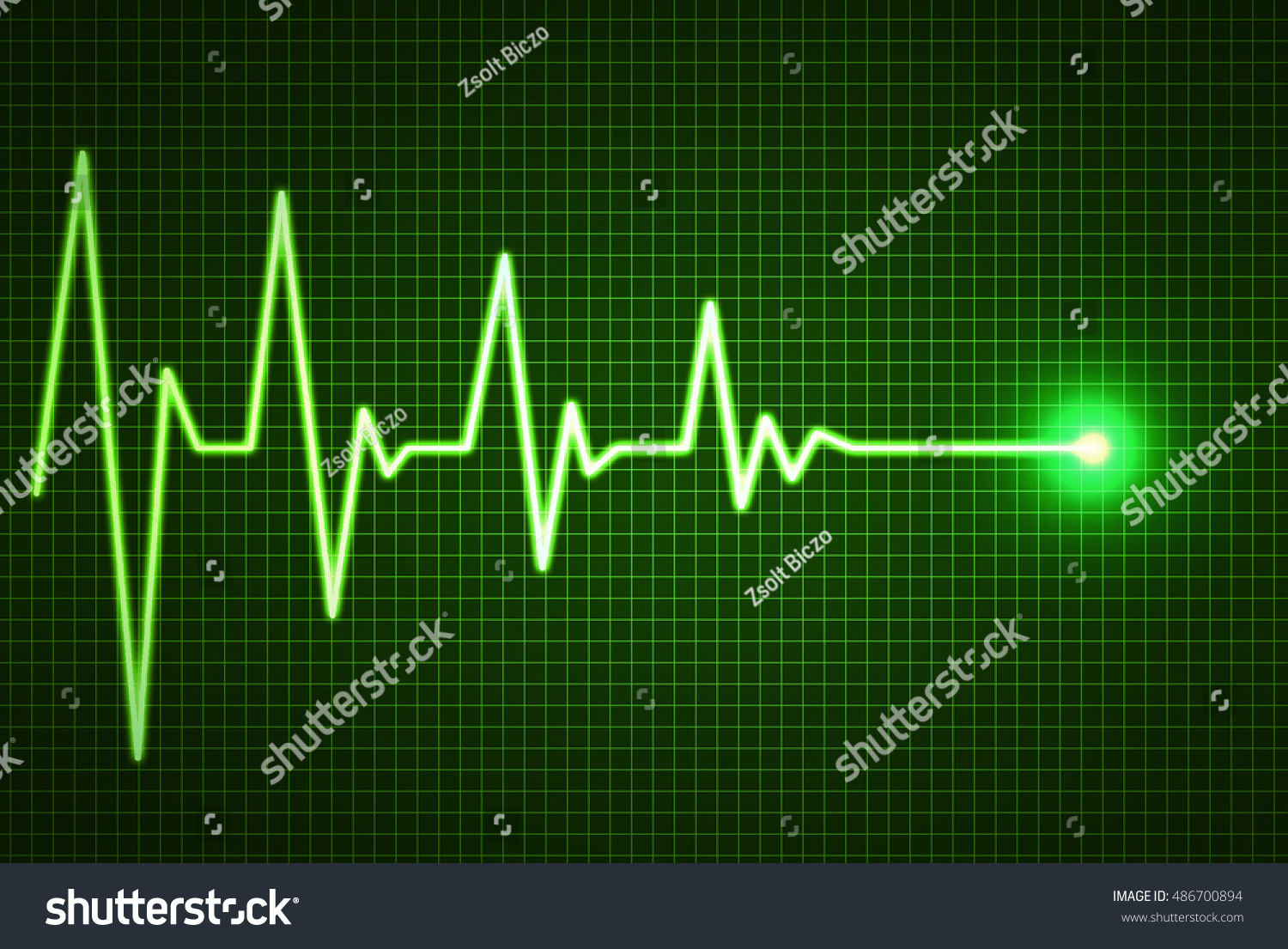Forum on this topic: 3-D Images Help Cardiologists End Heart Rhythm , 3-d-images-help-cardiologists-end-heart-rhythm/ Discussion on this topic: 3-D Images Help Cardiologists End Heart Rhythm , 3-d-images-help-cardiologists-end-heart-rhythm/
