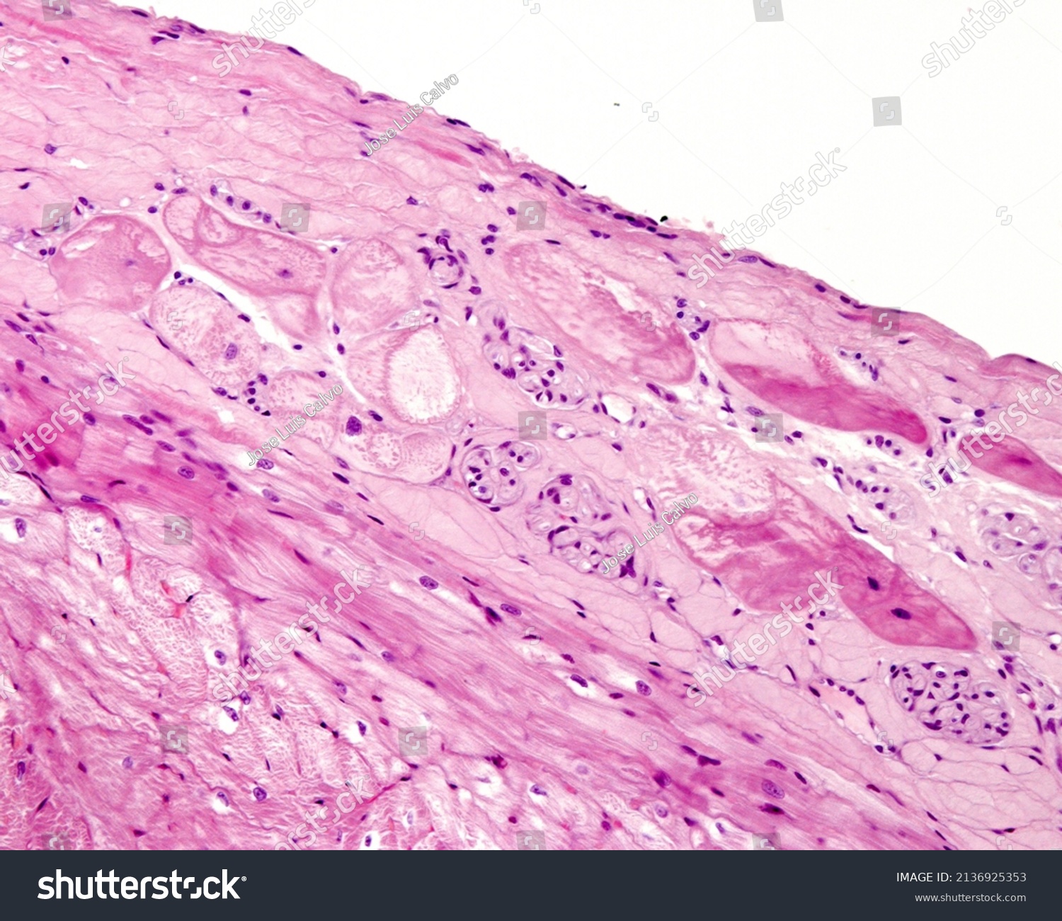 Heart Purkinje Fibers Part Conducting System Stock Photo 2136925353 ...