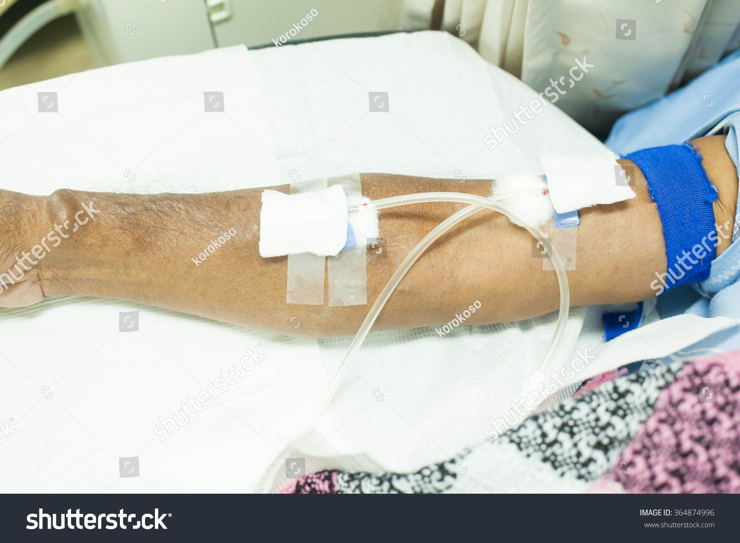 Hemodialysis Stock Photo Edit Now 364874996