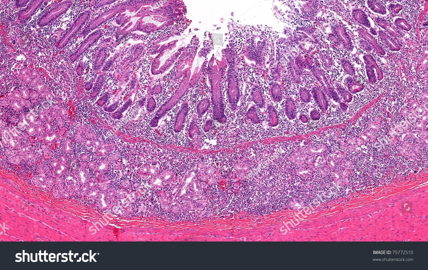 Highly Magnified Microscopic View Of Small Intestine (Duodenum) With ...