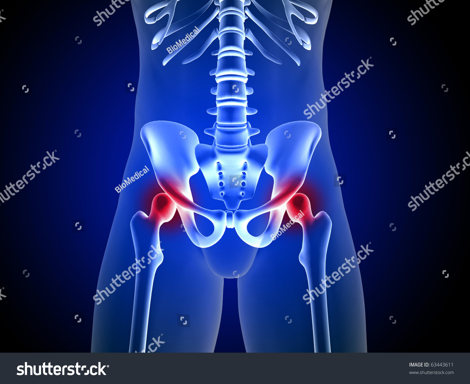 Hip Joint Pain Stock Illustration 63443611 - Shutterstock