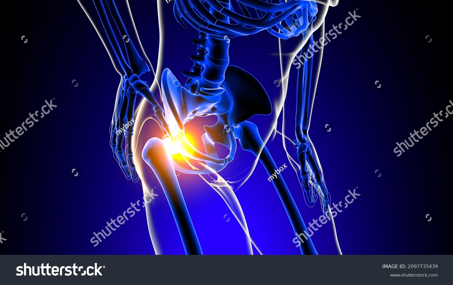 Hip Joint Pain Anatomy Medical Concept Stock Illustration 2097735439