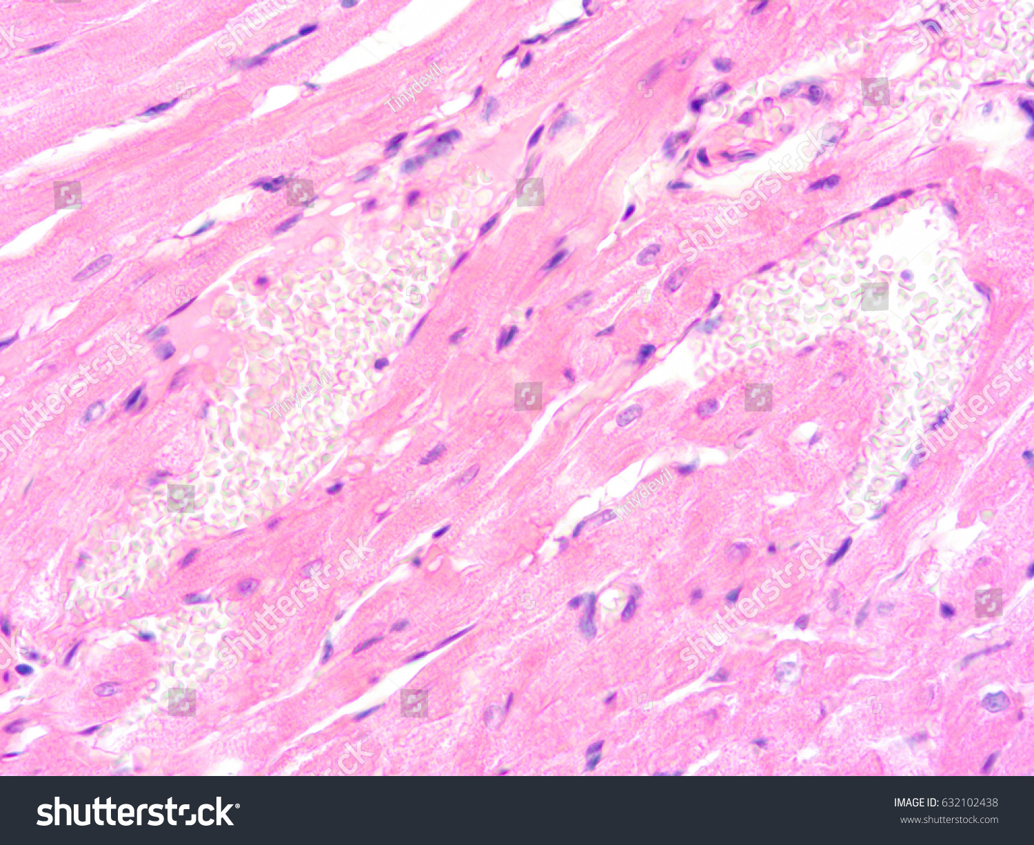 Histology Human Heart Tissue Show Cardiac Stock Photo (edit Now) 632102438