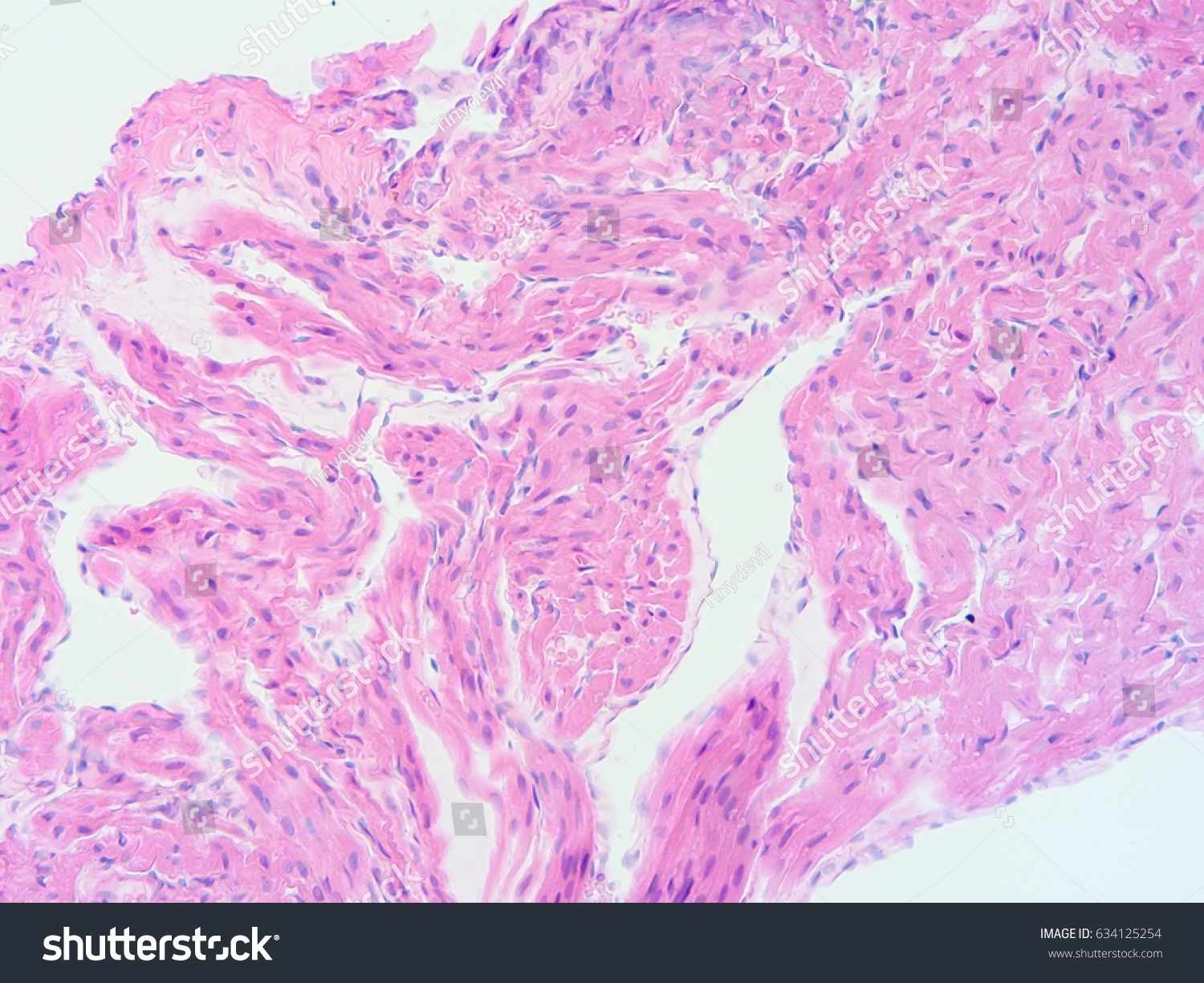 Histology Human Heart Tissue Show Cardiac Stock Photo 634125254 ...