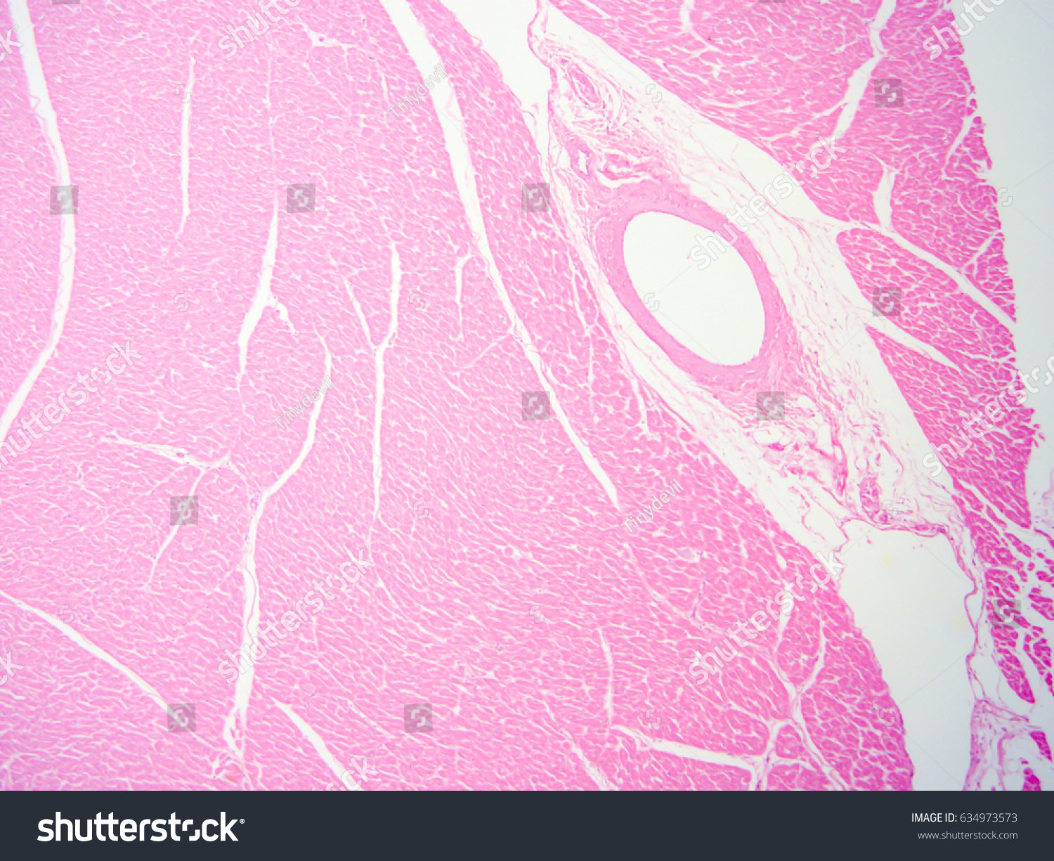 Histology Human Heart Tissue Show Cardiac Stock Photo (Edit Now) 634973573