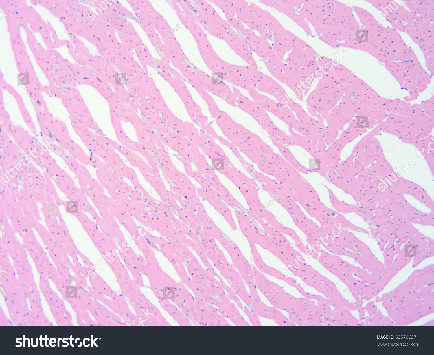 Histology Human Heart Tissue Show Cardiac: Foto Stock (editar Agora ...