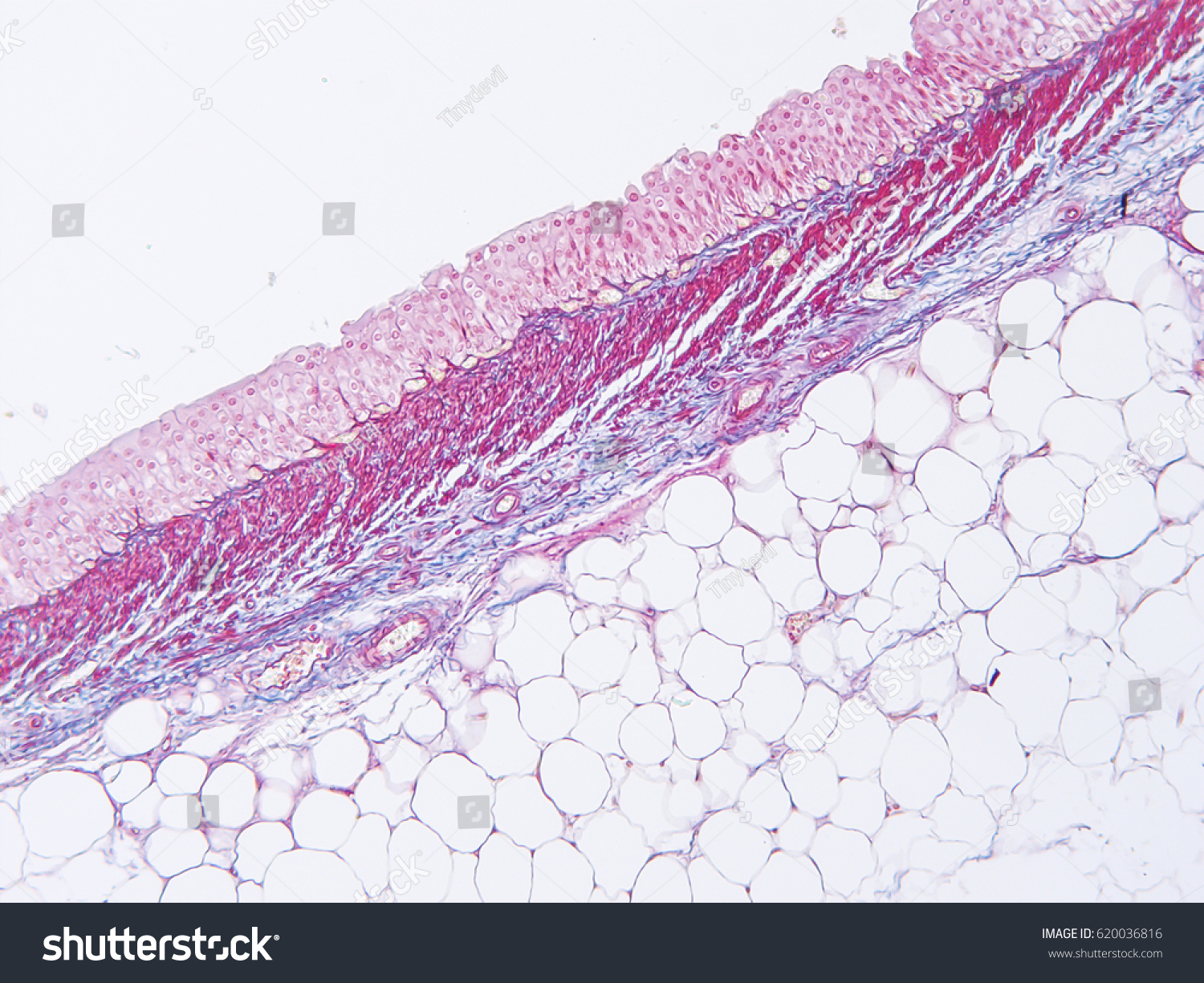 Histology Human Intestine Show Epithelium Tissue Foto De Stock Editar