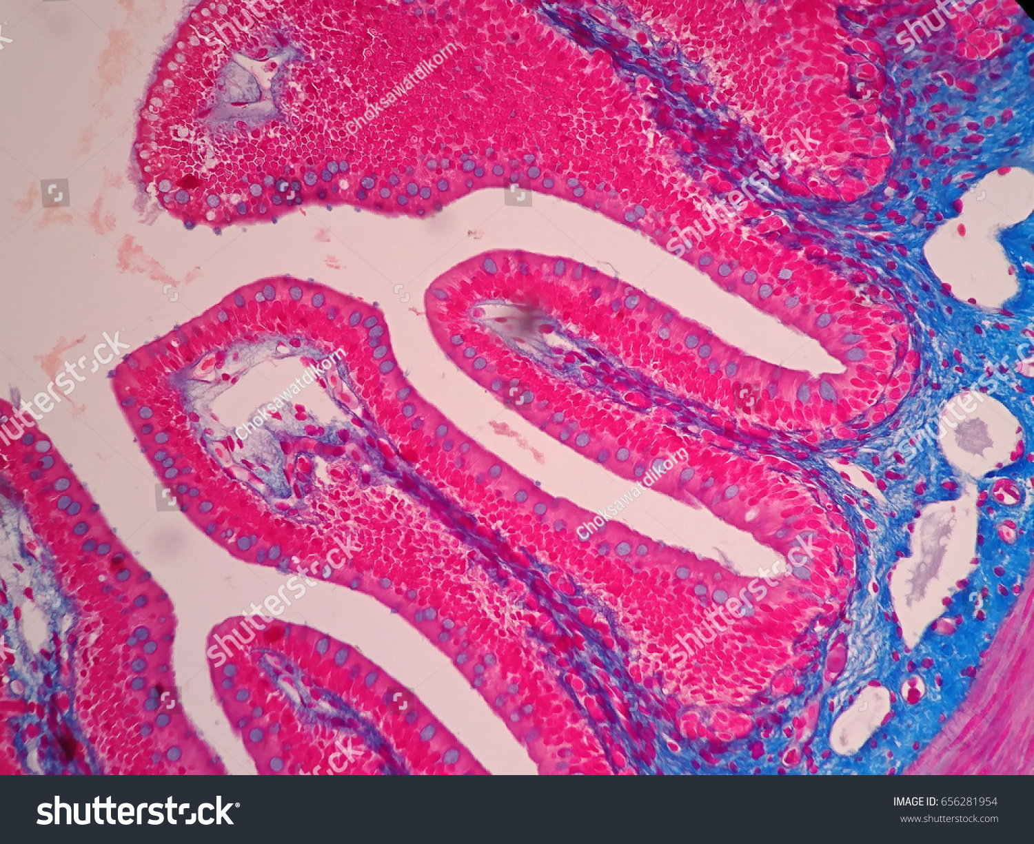 Histology Human Intestine Tissue Under Microscope Stock Photo 656281954 ...