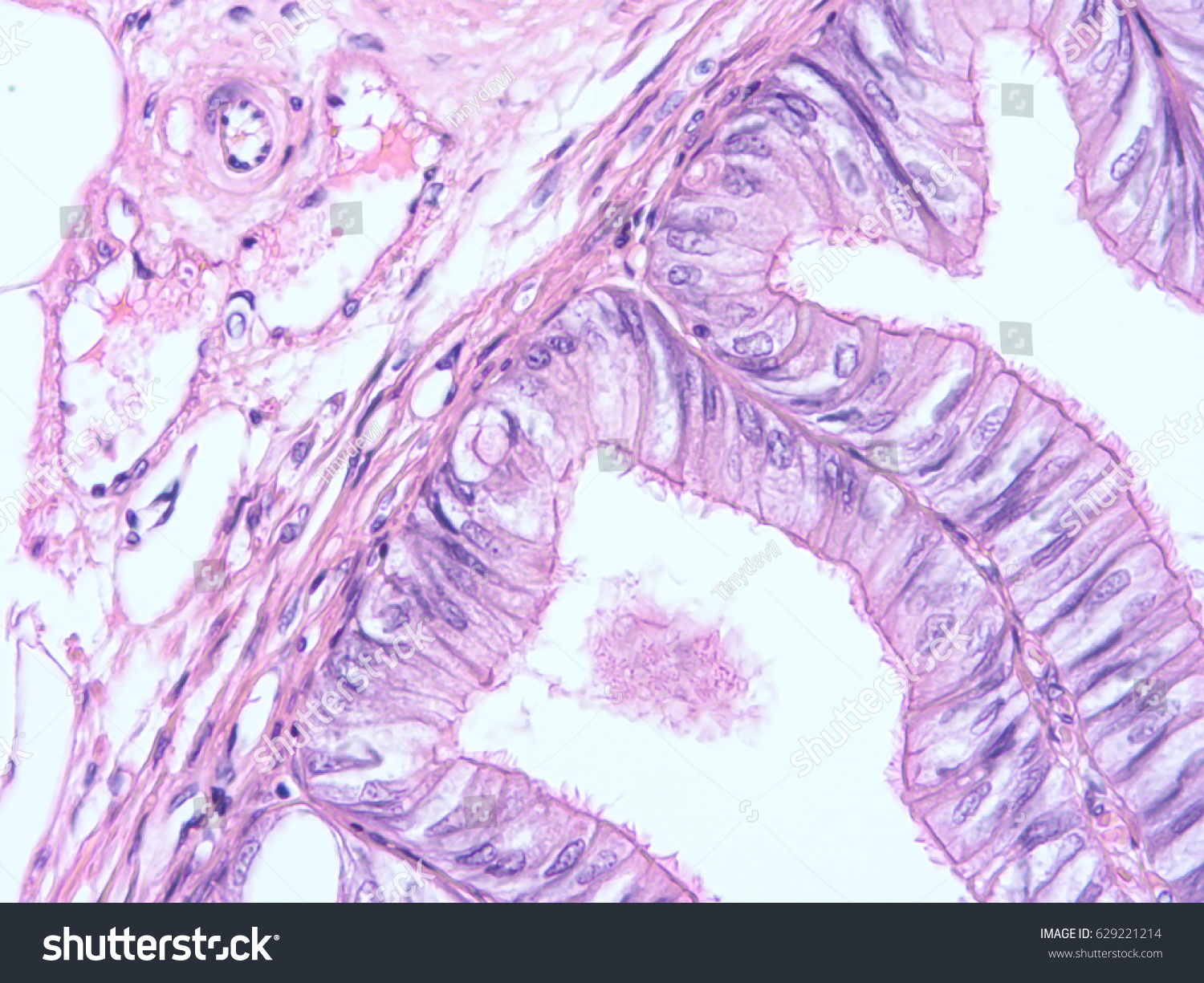 Histology Human Tissue Show Columnar Epithelium Stock Photo 629221214 ...