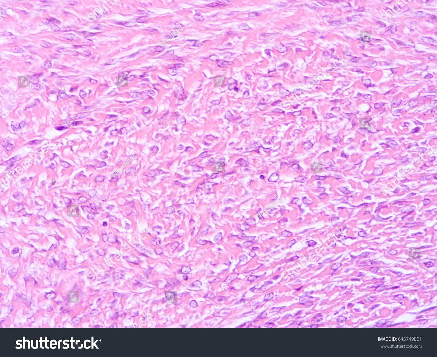 Histology Human Tissue Show Fibrous Cartilage Stock Photo (Edit Now ...