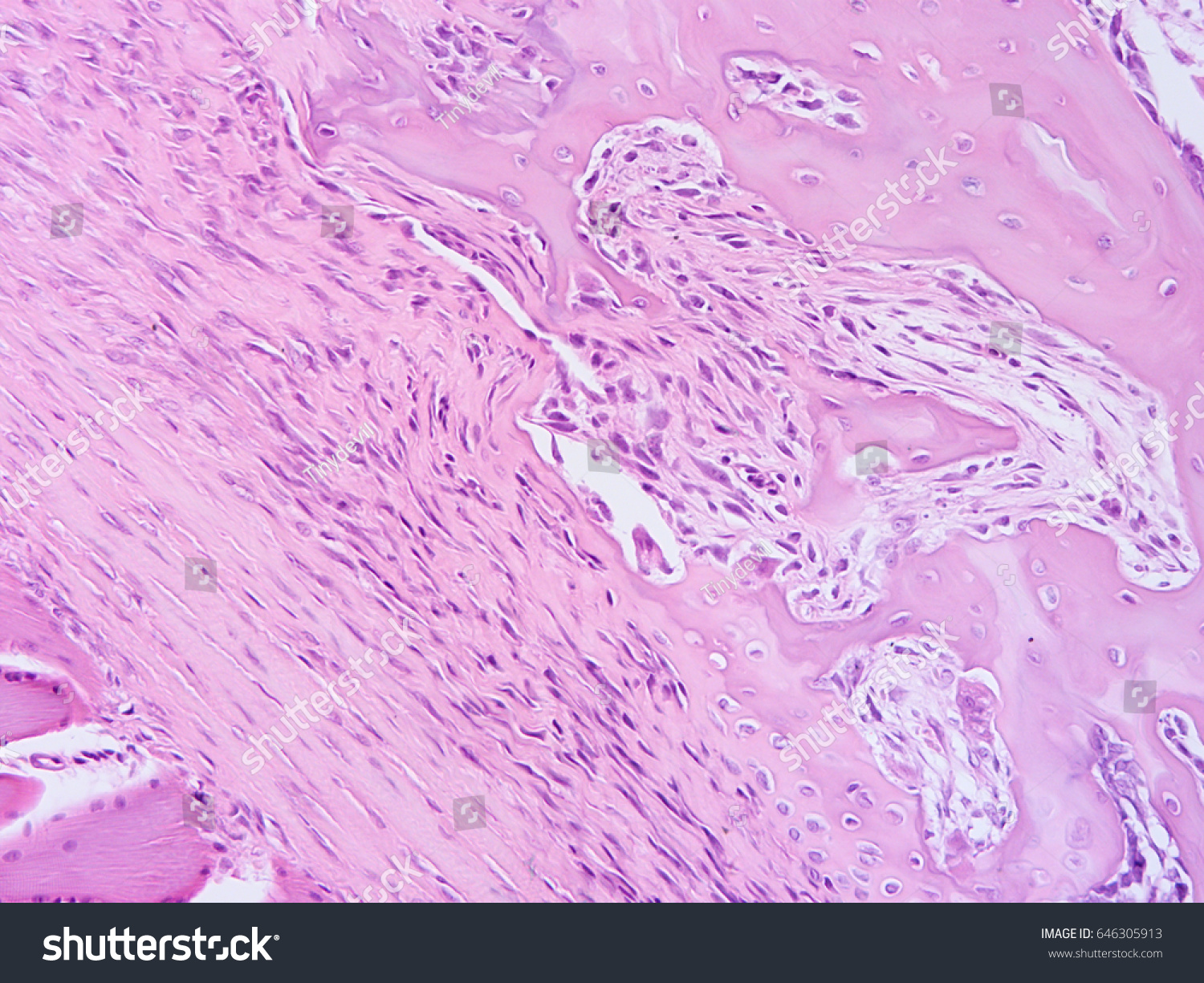 Elastic Cartilage Tissue Under The Microscope Preview Histology Kenhub