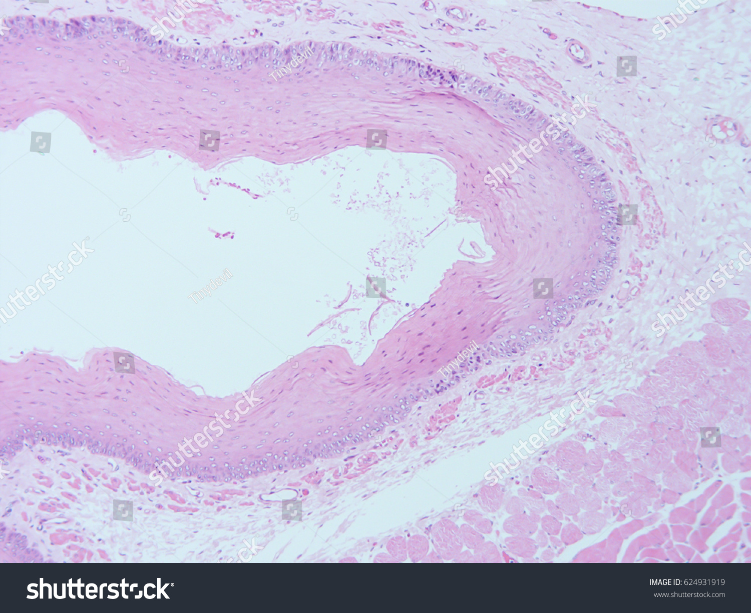 Histology Human Tissue Show Stratified Squamous Stock Photo (Edit Now ...