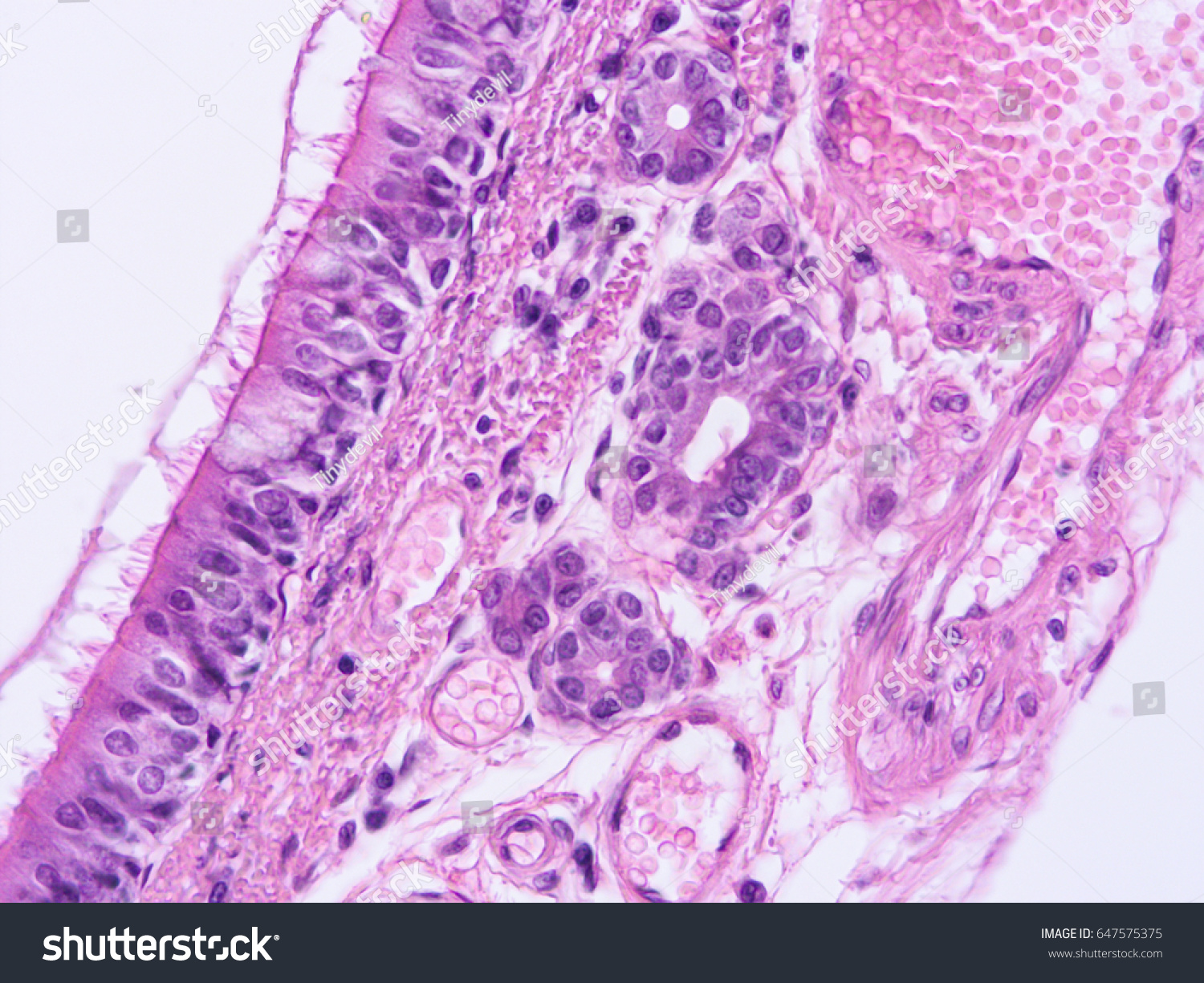 Histology Human Trachea Tissue Show Cartilage ภาพสต็อก แก้ไขตอนนี้ 647575375 