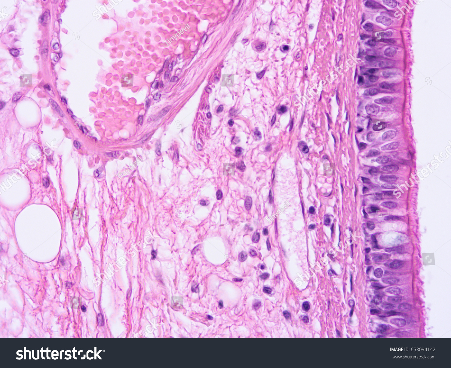 Histology Human Trachea Tissue Show Cartilage Stock Photo 653094142 ...